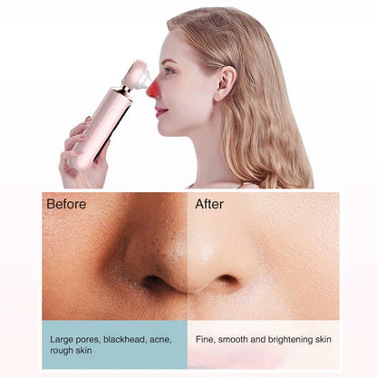 GlowTech™ Blackhead Suction Machine