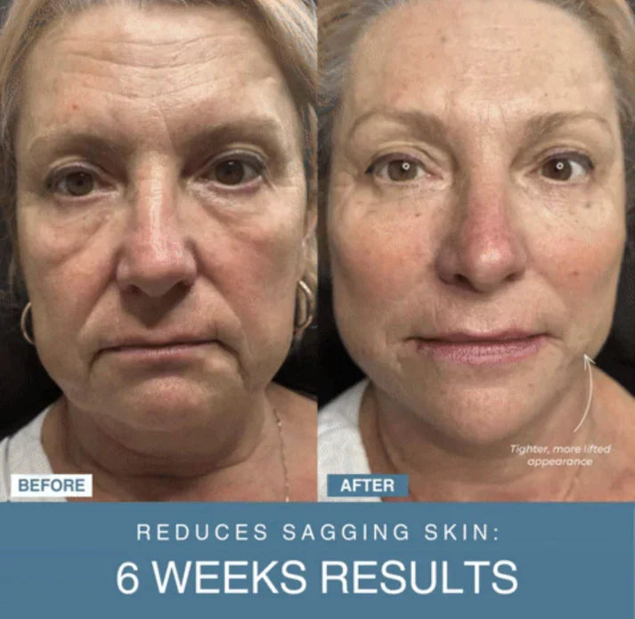 GlowTech™ 7-in-1 LED Anti-Aging/Wrinkle Apparatus