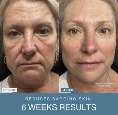 GlowTech™ 7-in-1 LED Anti-Aging/Wrinkle Apparatus