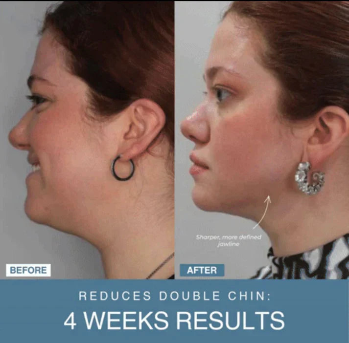 GlowTech™ 7-in-1 LED Anti-Aging/Wrinkle Apparatus