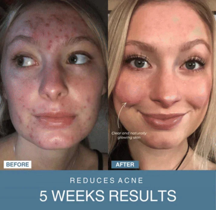 GlowTech™ 7-in-1 LED Anti-Aging/Wrinkle Apparatus
